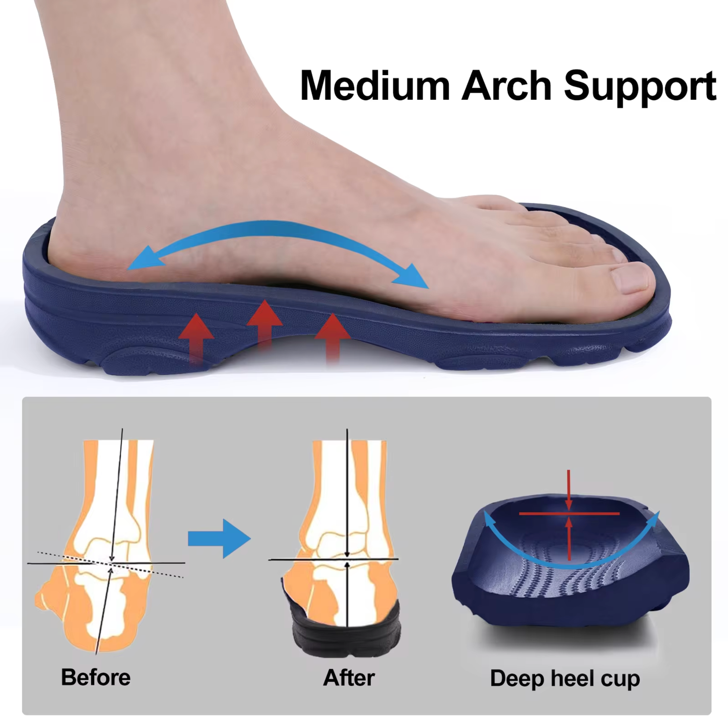Chaussons Orthopédiques Compensés pour Hommes | Crestar